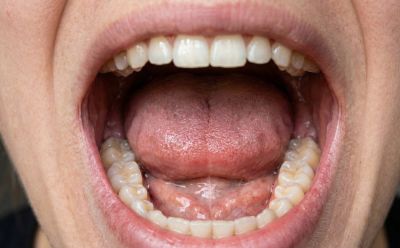 The singing airstream: whistling between biology and art